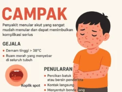 Dokter Muda Meninggal Akibat Campak, Upaya Pencegahan Penularan Efektif