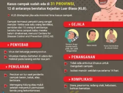 Fakta-Fakta Campak di Tangerang yang Menyamar Seperti Flu, Kenapa Tetap Mewabah walau Sudah Vaksin?