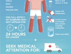 First Aid Sunburn Si Kecil Saat Lagi Libur Lebaran 2026: Jangan Lakukan Ini Moms!