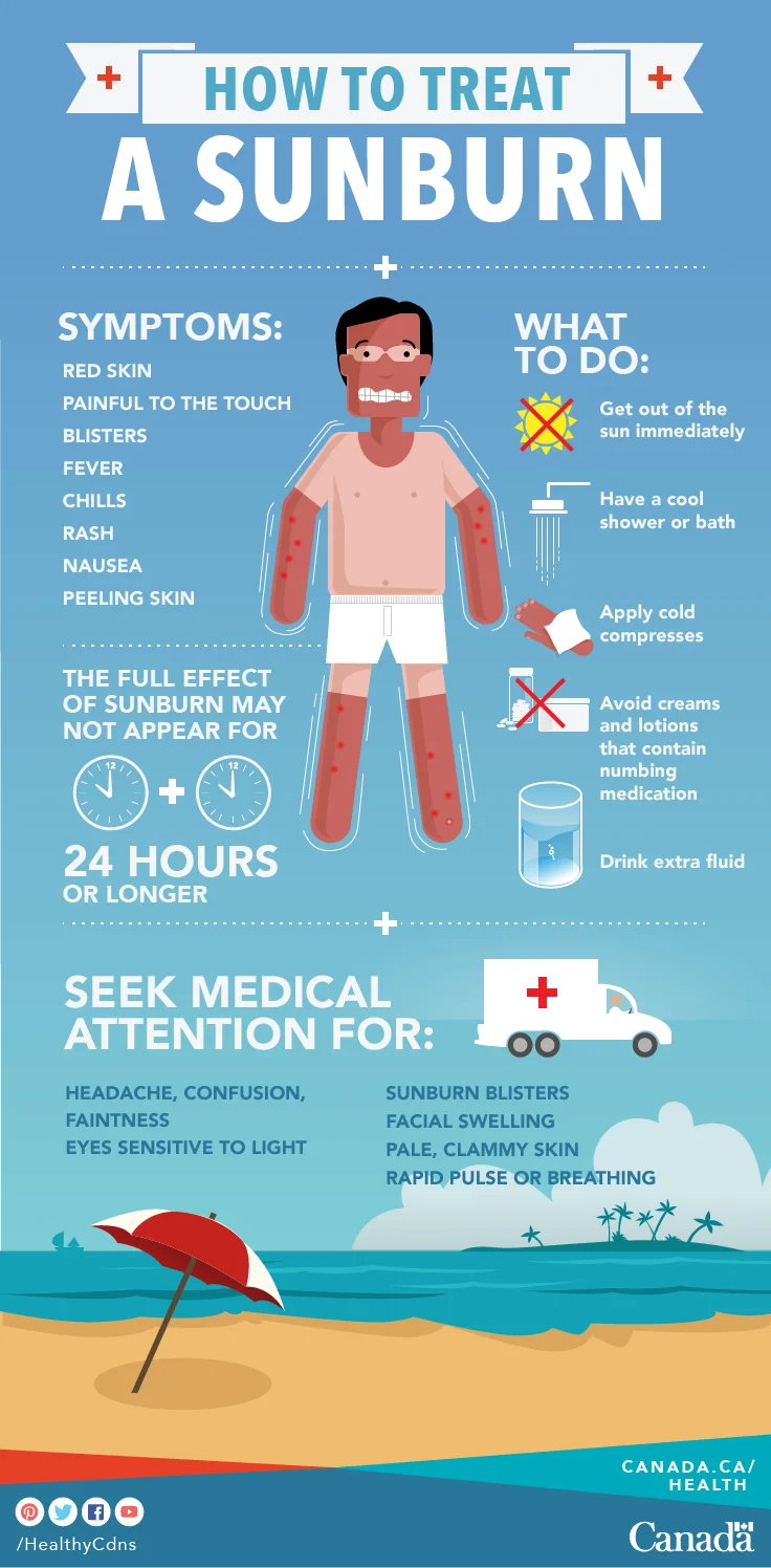 First Aid Sunburn Si Kecil Saat Lagi Libur Lebaran 2026: Jangan Lakukan Ini Moms!