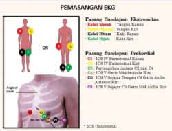 Kapan Waktu yang Tepat untuk Melakukan EKG? Jawaban Dokter