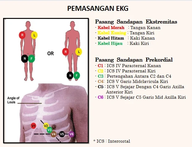 Kapan Waktu yang Tepat untuk Melakukan EKG? Jawaban Dokter