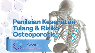 Kesehatan Tulang Sering Diabaikan, Padahal Risiko Sudah Mengintai di Usia Muda