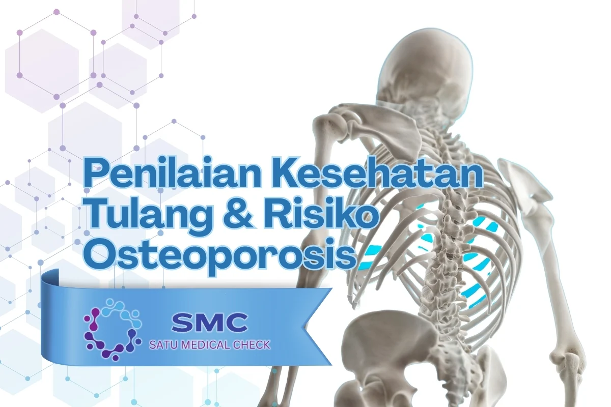 Kesehatan Tulang Sering Diabaikan, Padahal Risiko Sudah Mengintai di Usia Muda