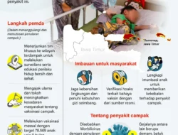 Meninggalnya Dokter Internship Karena Campak Picu Aksi Cepat Dinkes Jabar dan Kemenkes