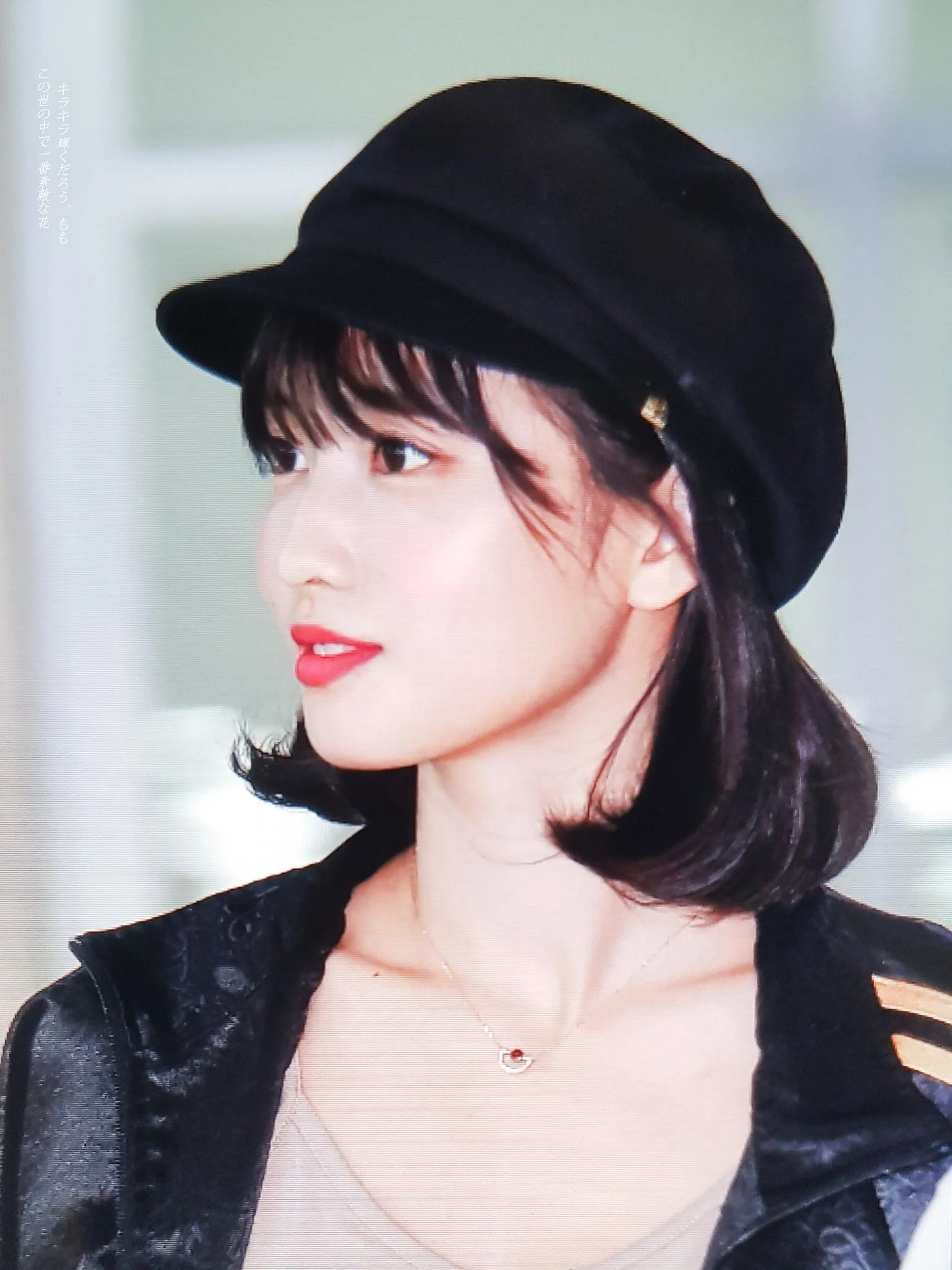 Momo TWICE Cabut Gigi Saat Tur Amerika, Tetap Tampil Meski Pipi Bengkak