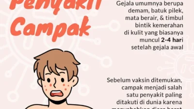 Waspada Campak pada Dewasa: Risiko Kesehatan Tinggi, Beban Ekonomi Juga Mengintai