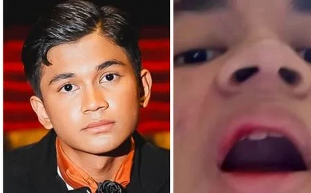 Kekerasan Tak Terduga: Muzakki Ramdhan Jadi Korban, Bibir Berdarah Meski Sudah Minta Maaf